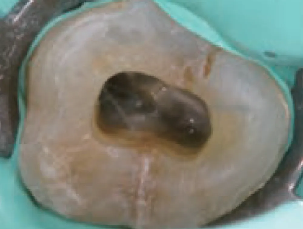 canal-seek-comparaison-1