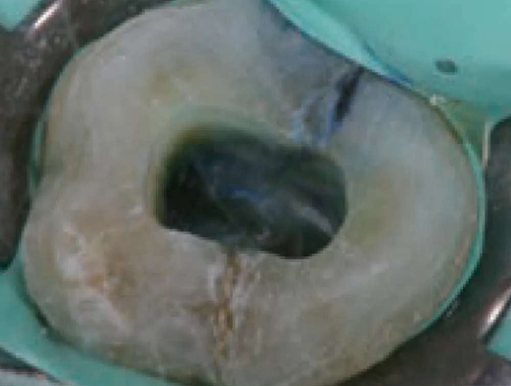 canal-seek-comparaison-2