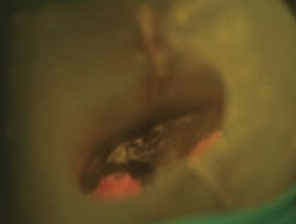 canal-seek-comparaison-3