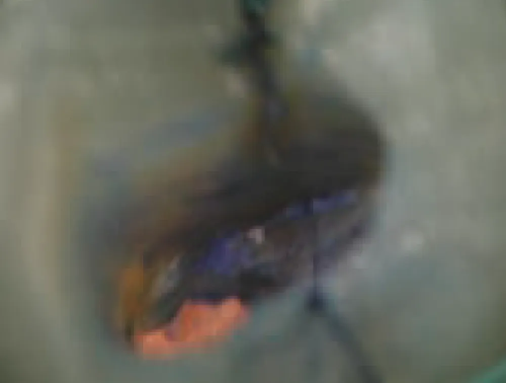 canal-seek-comparaison-4