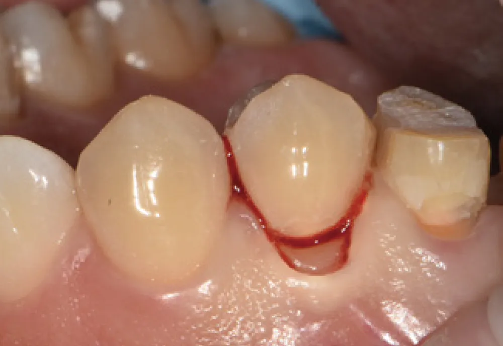 cas-one-stop-1 cas-one-stop-1