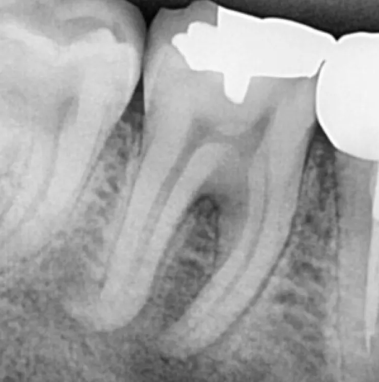 cas-onefil-1 cas-onefil-1