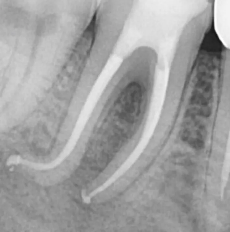 cas-onefil-2 cas-onefil-2
