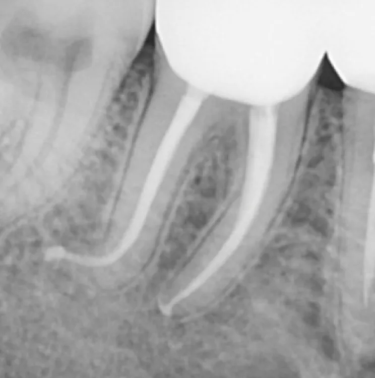cas-onefil-3 cas-onefil-3