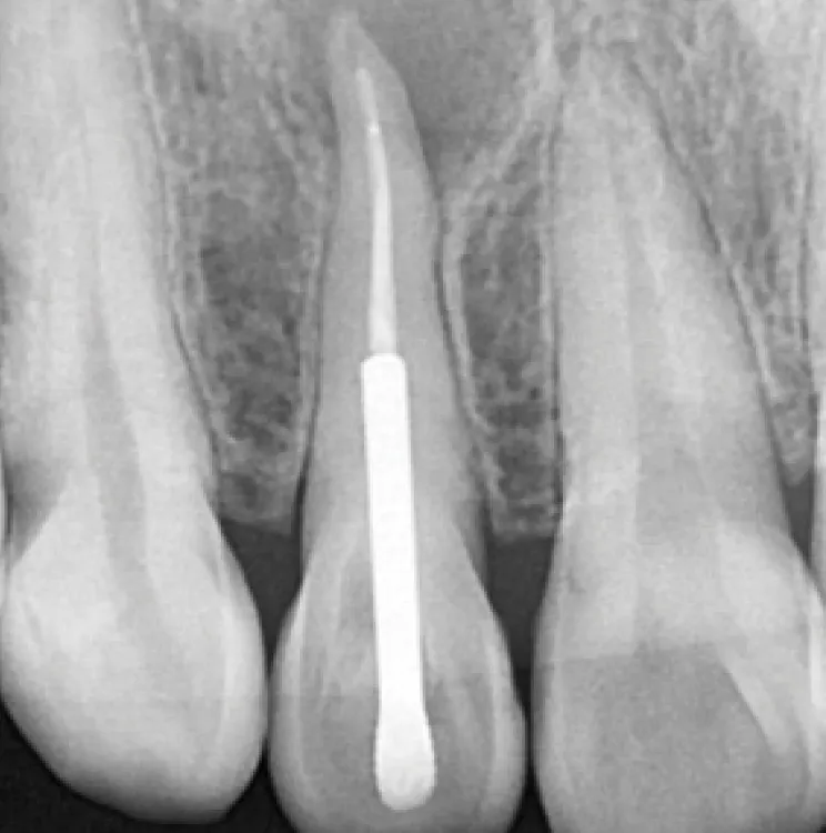 cas-onefil-4 cas-onefil-4