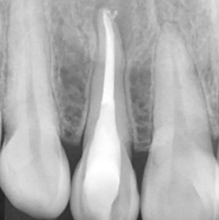 cas-onefil-6 cas-onefil-6