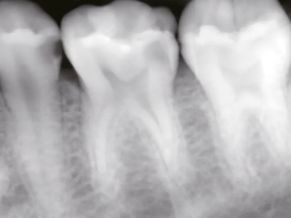 cas-onefilputty-1 cas-onefilputty-1