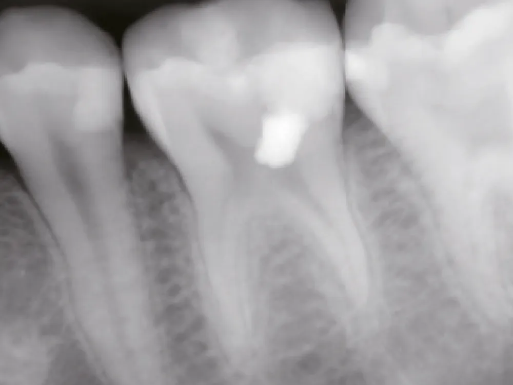 cas-onefilputty-2 cas-onefilputty-2