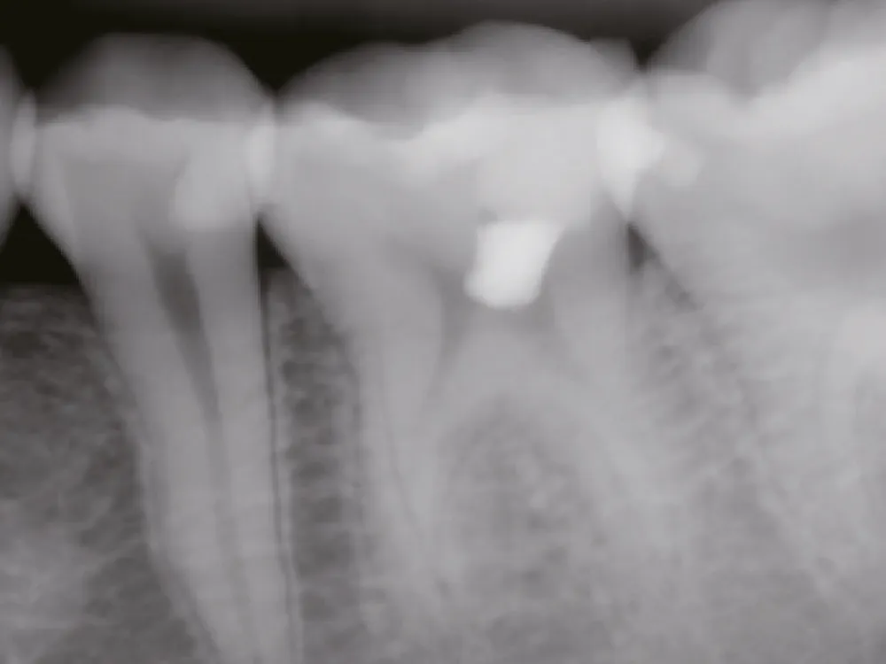 cas-onefilputty-3 cas-onefilputty-3