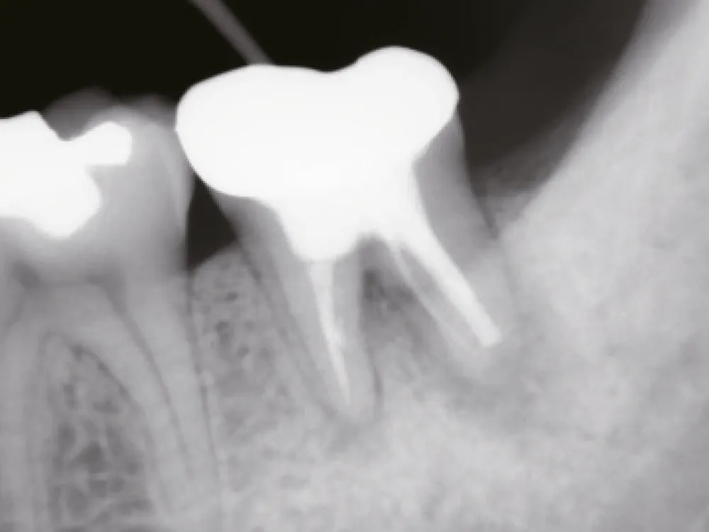 cas-onefilputty-4 cas-onefilputty-4