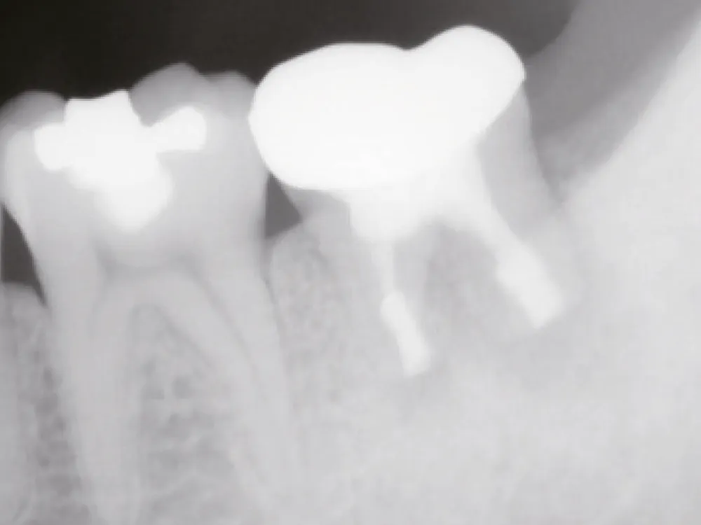 cas-onefilputty-5 cas-onefilputty-5