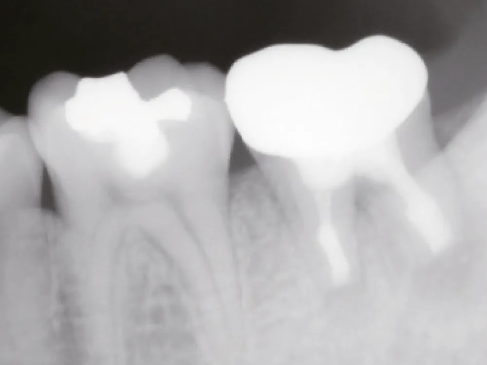 cas-onefilputty-6 cas-onefilputty-6