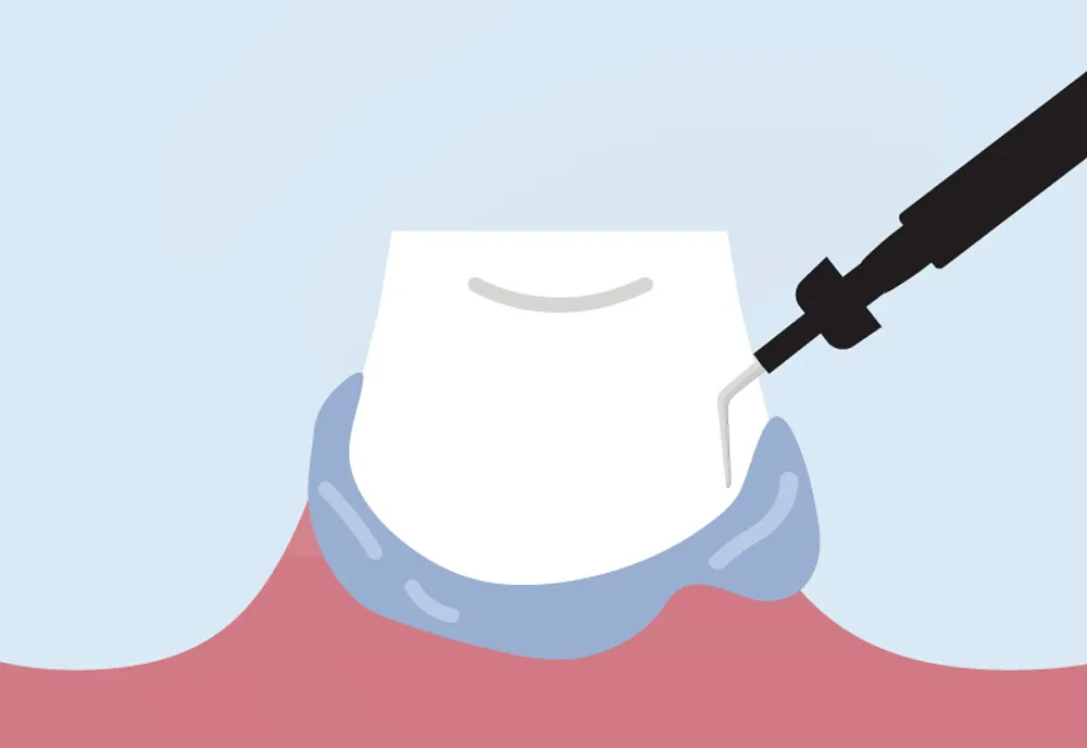 protocol-one-stop-2 protocol-one-stop-2